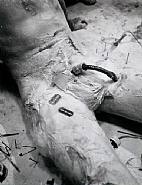 Günter Brus - Transfusion (Photographs) h: 30.5 x w: 23.8 cm / h: 12 x w: 9.4 in