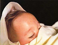 Andres Serrano - The Morgue (Fatal Meningitis II) (Glass) h: 49.5 x w: 60 in / h: 125.7 x w: 152.4 cm