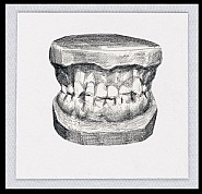 Semi-Functional Lost Fragments