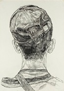 Subject B