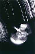Petah Coyne - Untitled #885 (Saucer Baby, Carolyn Rose Series), 1997